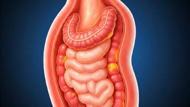 Gastroesophageal