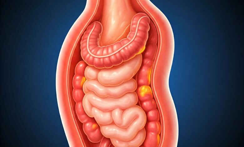 Gastroesophageal